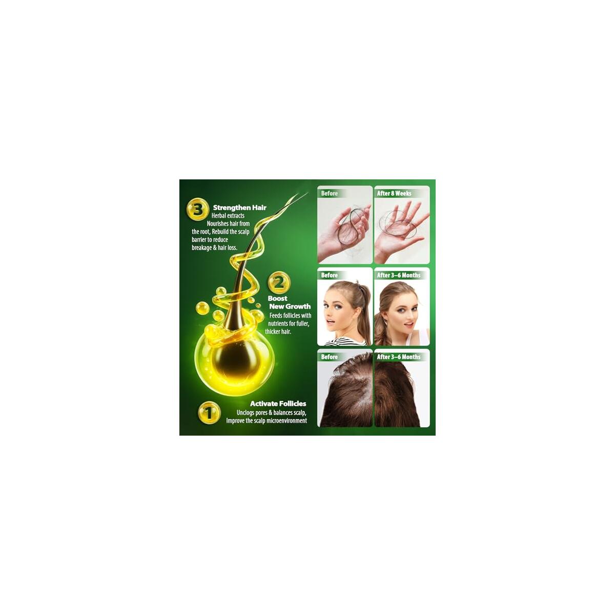 Scalpy Herbal Hair Growth Serum For Thicker Hair Cash Back - RebateKey