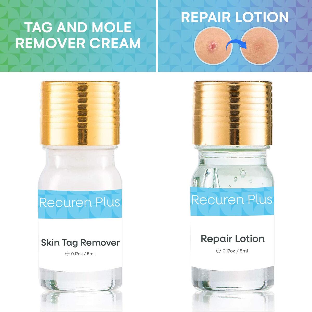 Mole Remover 1 Cashback Rebate - RebateKey