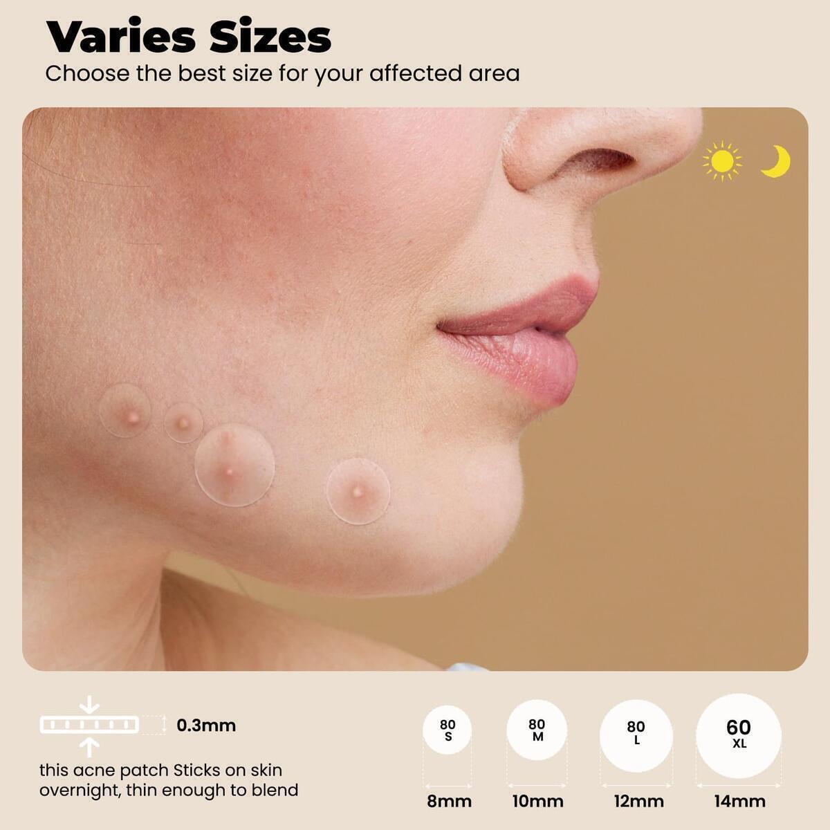 Roselynboutique Pimple Patches 1 Cashback - RebateKey