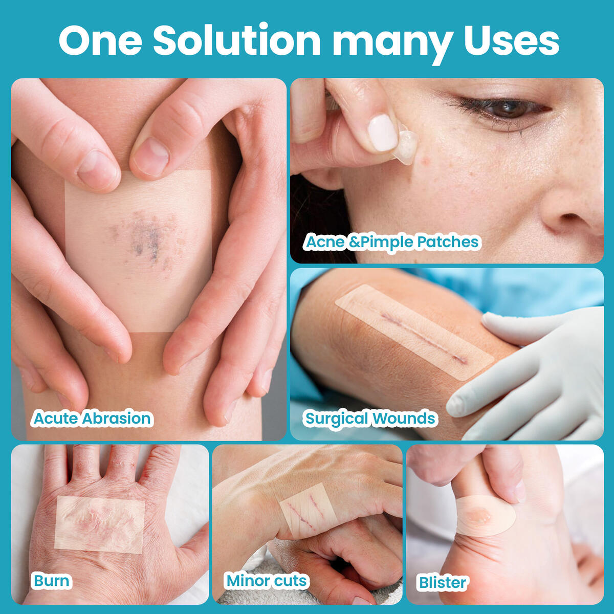 Hydrocolloid Roll For Wound Cash Back - RebateKey