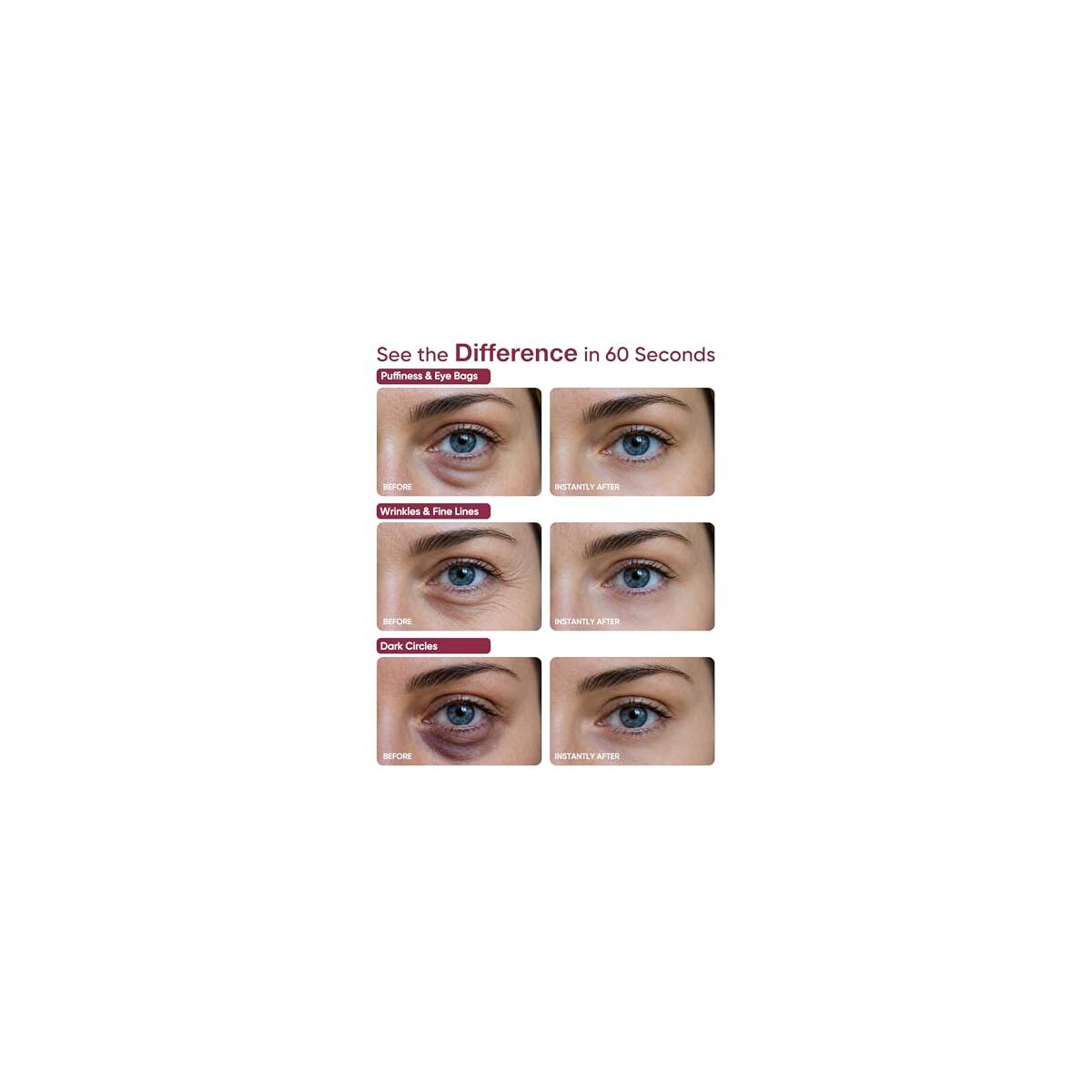 Zvye Instant Eye Face Lift Cream Cashback - RebateKey