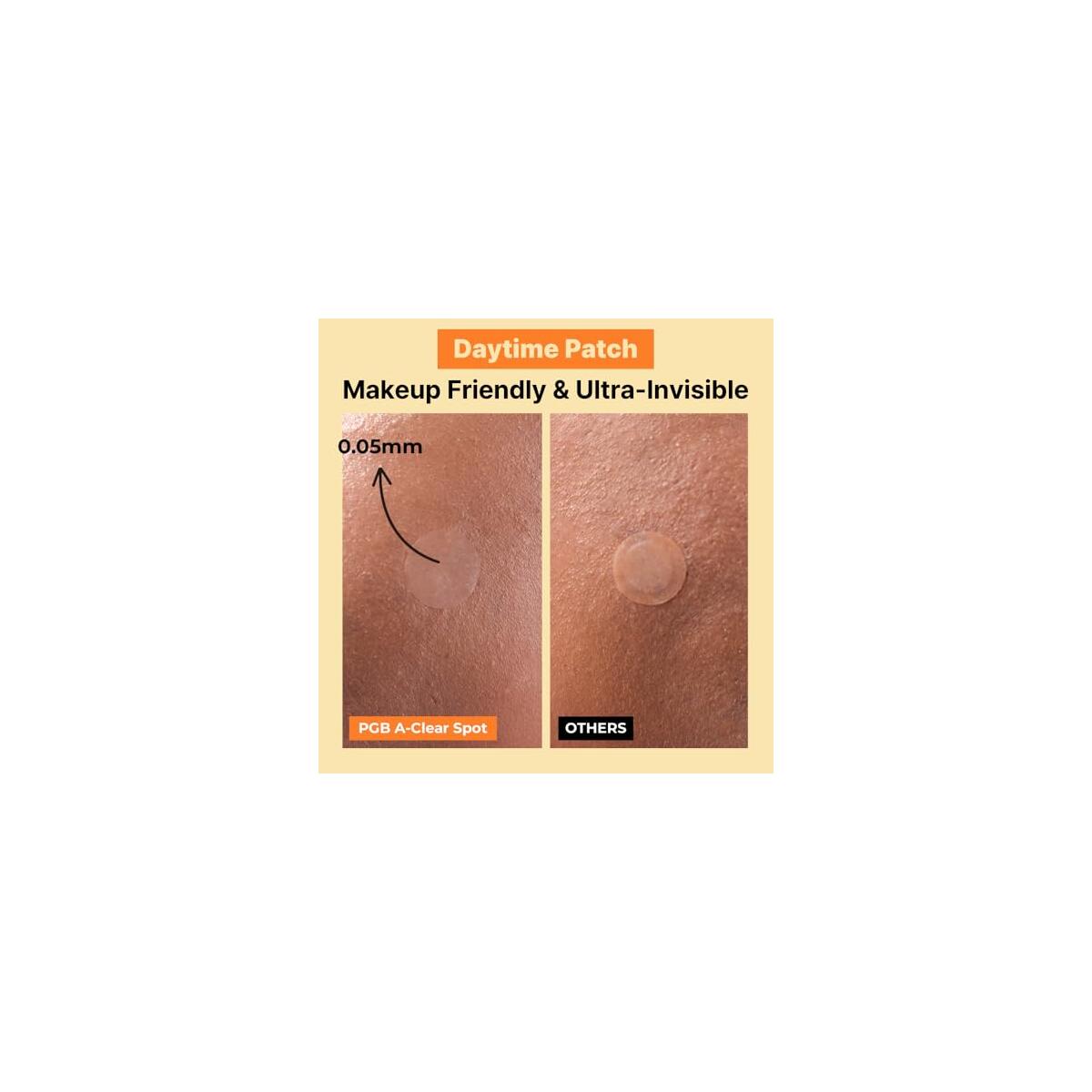 Pimple Patch 3 Cashback Rebate - RebateKey