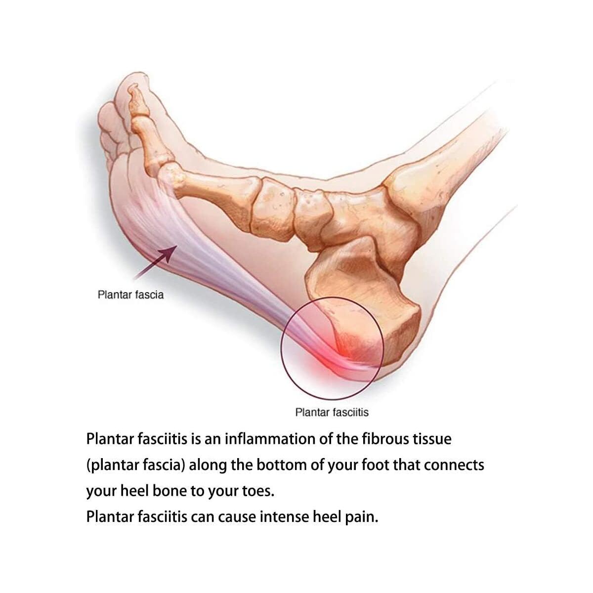 Arch Support Pad Cashback Rebates - RebateKey